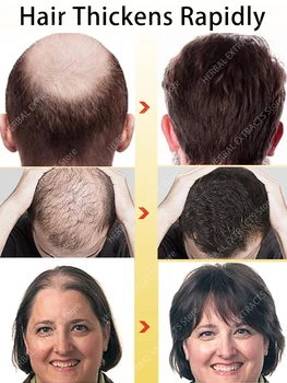 Серум за растеж на коса, за мъже и жени